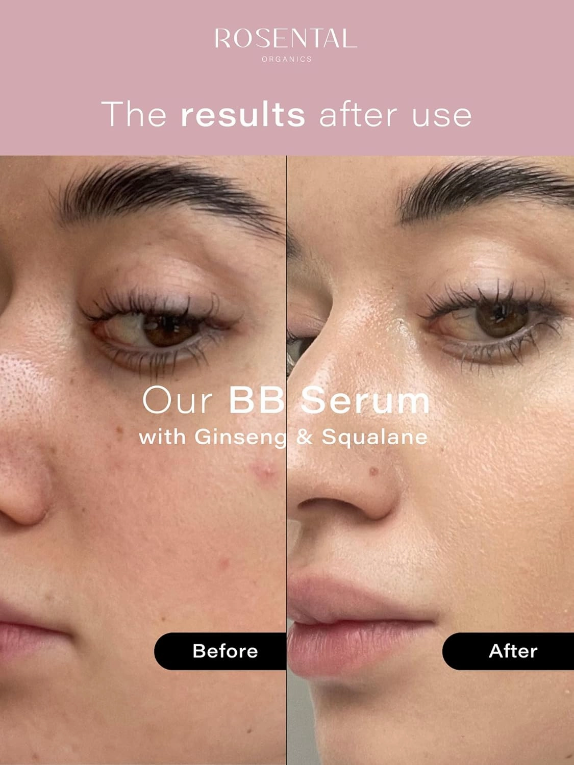 Organics BB Serum with Squalane & Ginseng – Hydrating Tinted Serum for Face, Anti-Aging Lightweight Skin Tint Moisturizer, Natural Makeup with Glow, Light Coverage Foundation, Medium